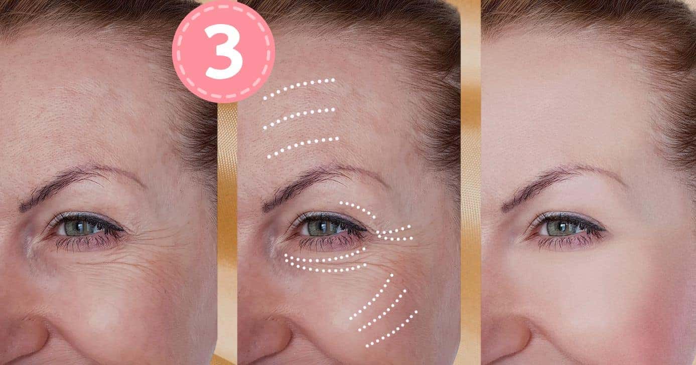 3 ingredientes põe fim nas rugas (Foto: Reprodução / Canva / Montagem TV Foco)