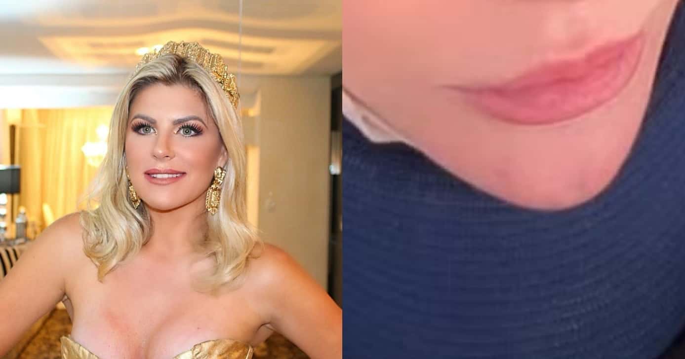 Lembra? Íris Stefanelli ressurge com procedimento e irreconhecível (Foto: Reprodução/Montagem TV Foco)