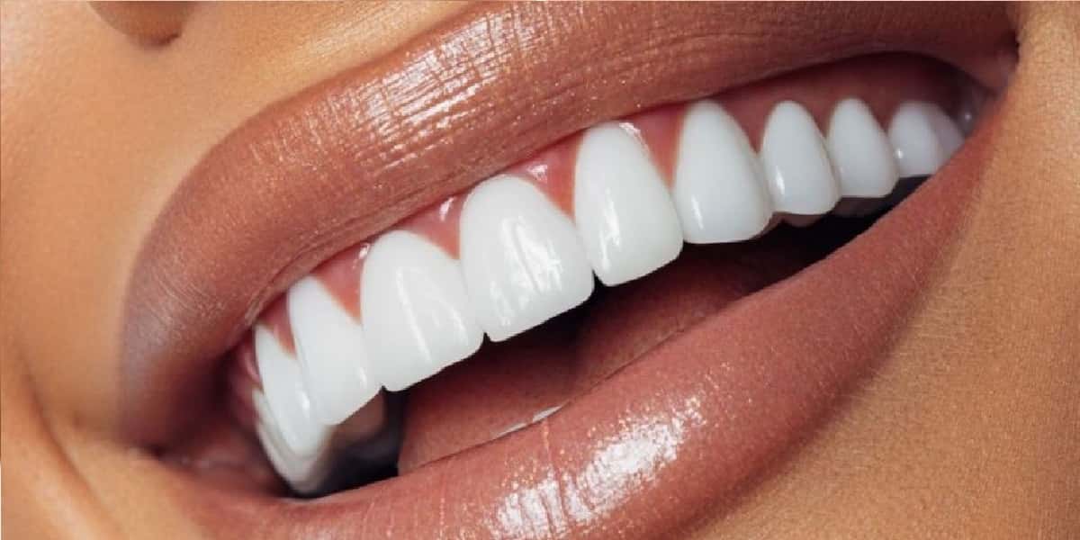 Dentes brancos - Foto: internet