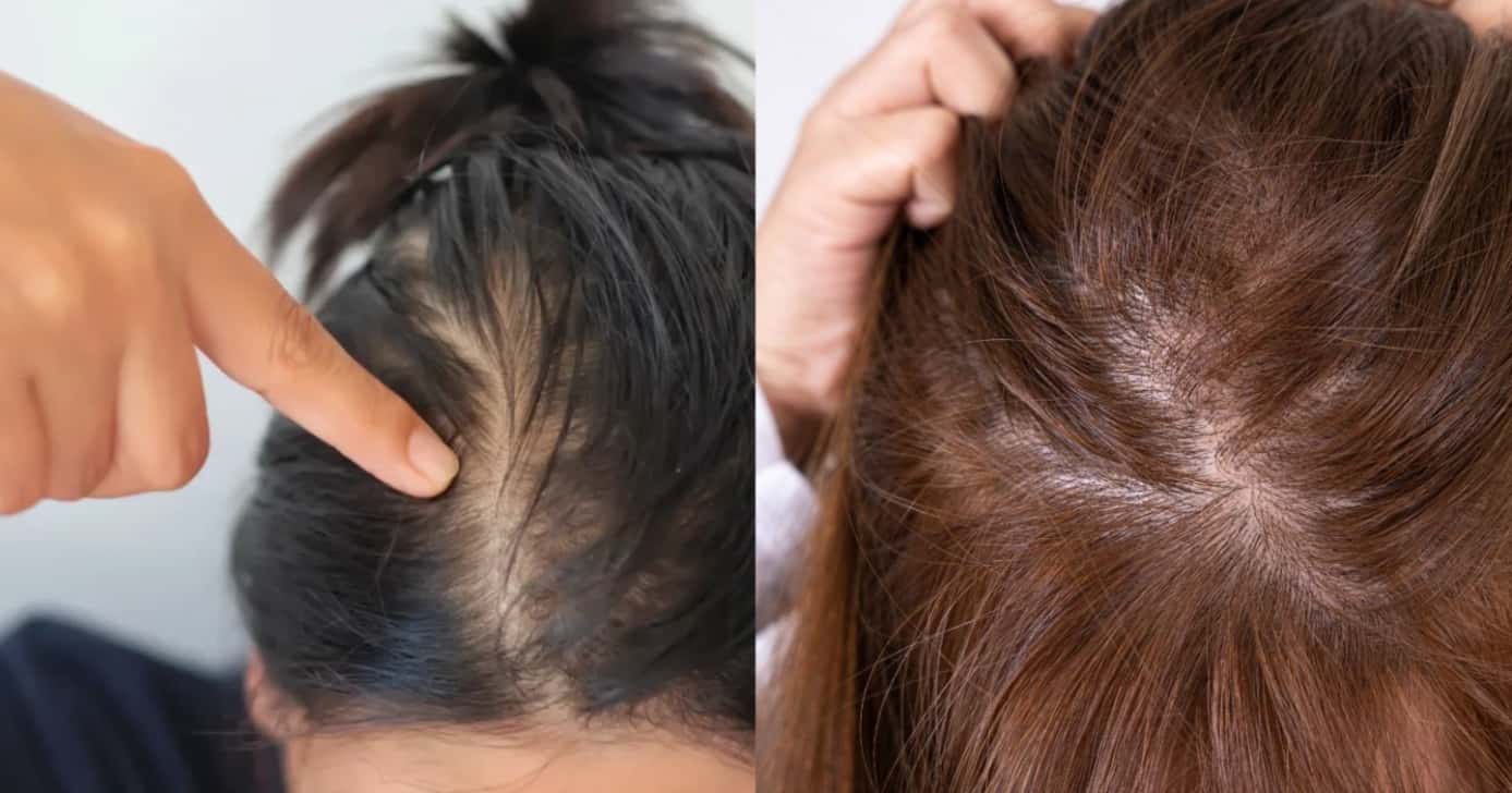 O erro que faz seu cabelo parecer mais fino - Foto: Montagem