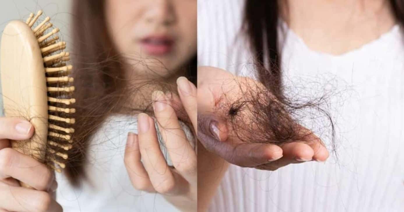 Queda de cabelo - Foto: Montagem