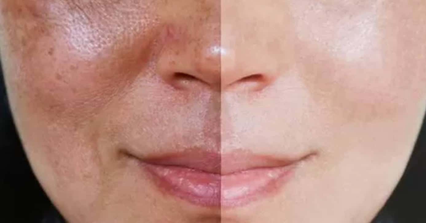 Técnica promete disfarçar às rugas e manchas do rosto das mulheres - Foto: Internet