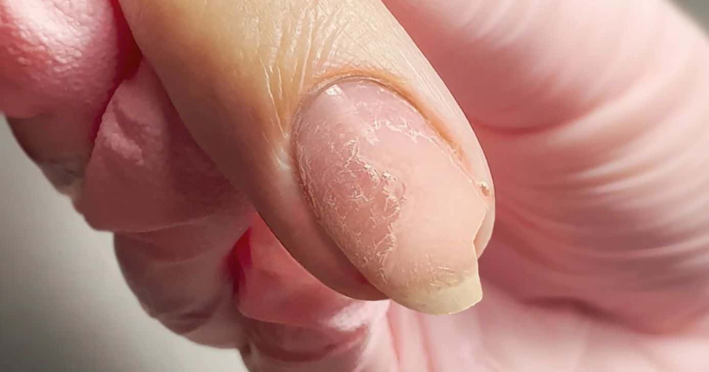 Unhas - Foto: Internet