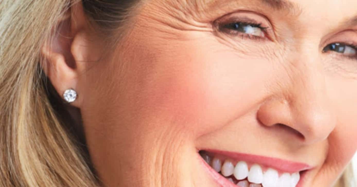 3 dicas infalíveis para as mulheres aniquilar de vez o pé de galinha - Foto: Internet