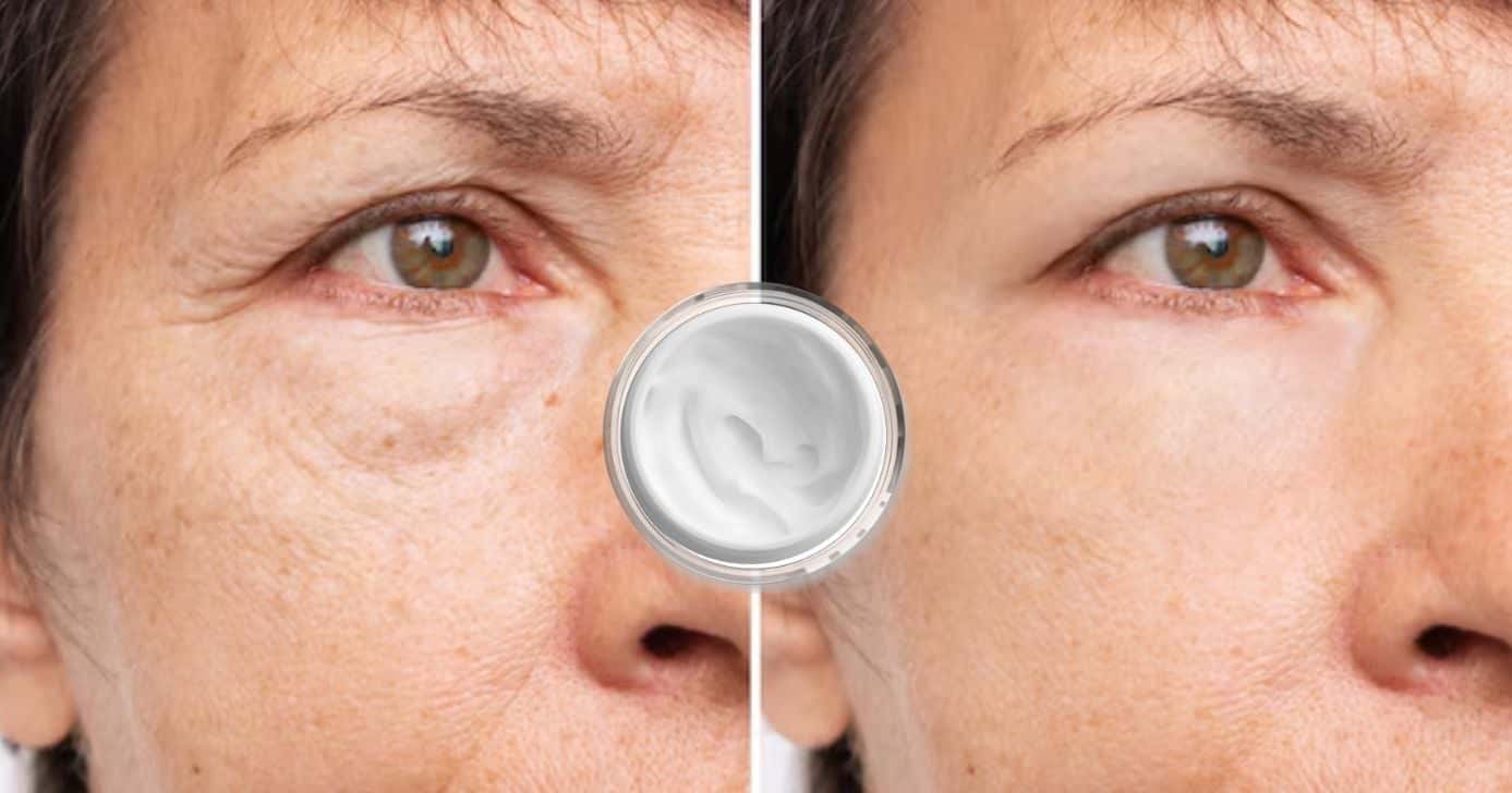Descubra o único ingrediente que elimina rugas em minutos para as mulheres 50+ (Foto Reprodução/Montagem/TV Foco/Canva/Paola)