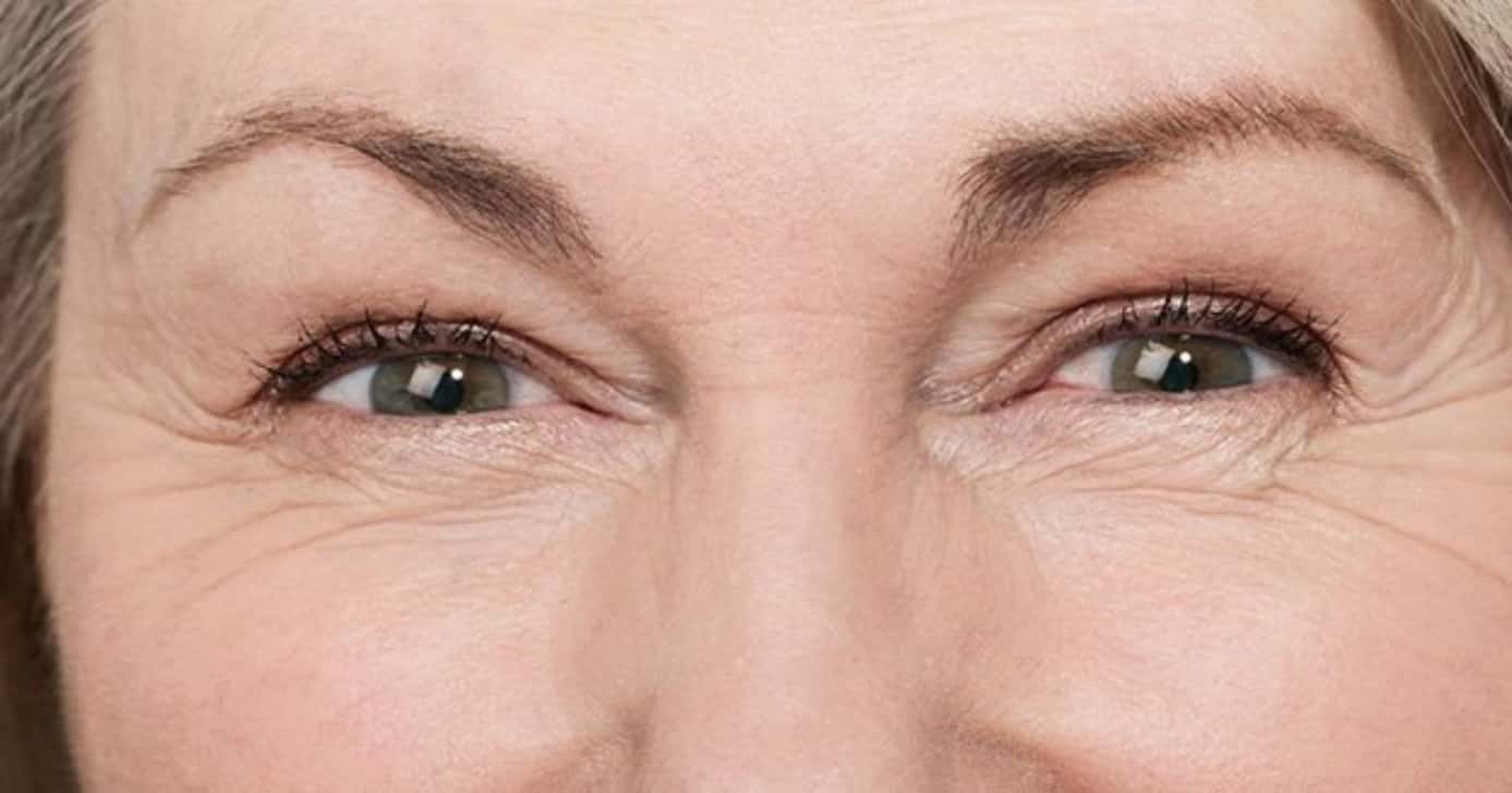 Como acabar com os pés de galinha (Foto: Divulgação)