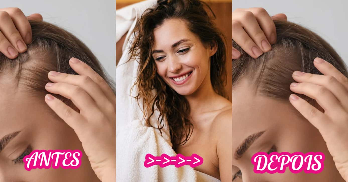Essas são as dicas que vão ajudar no crescimento do seu cabelo (Foto: Divulgação)