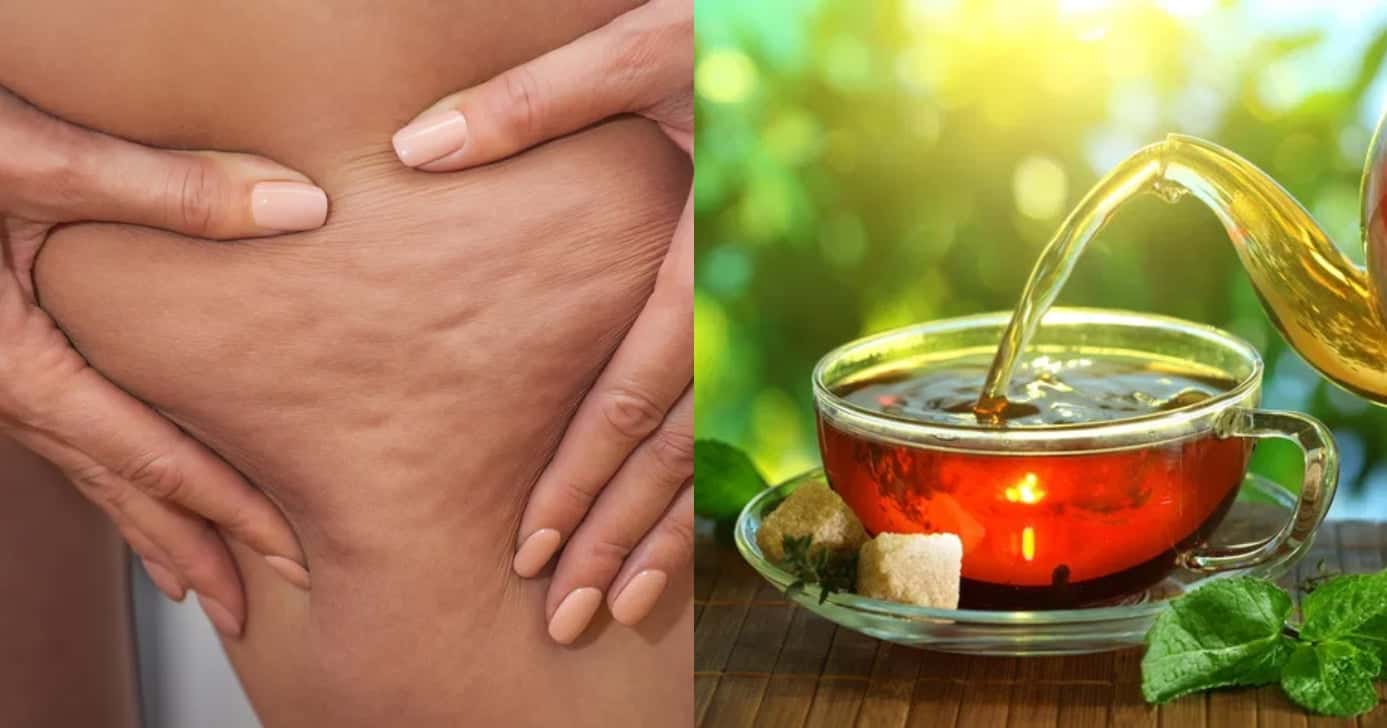 Saiba quais ingredientes usar para fazer um chá que ajuda a reduzir as celulites (Foto: Divulgação)