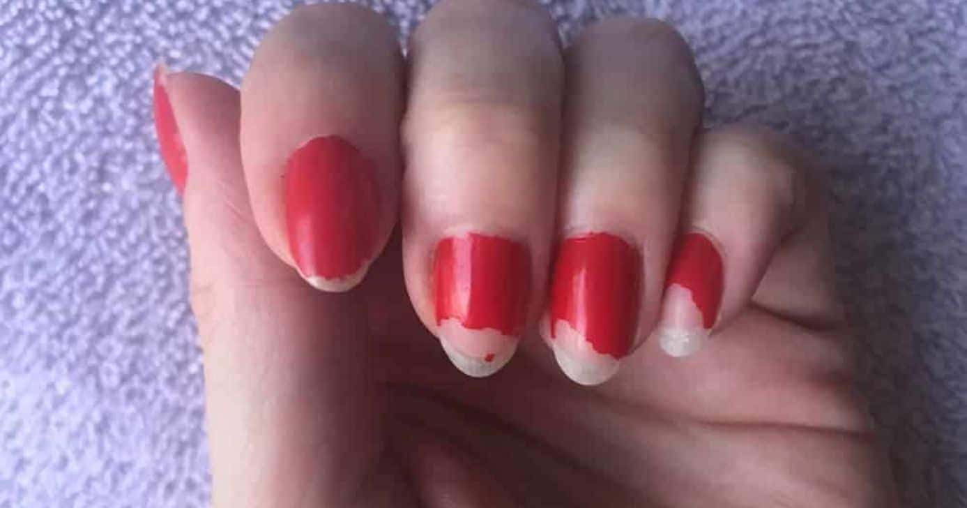 Esmalte descascando - Foto Internet
