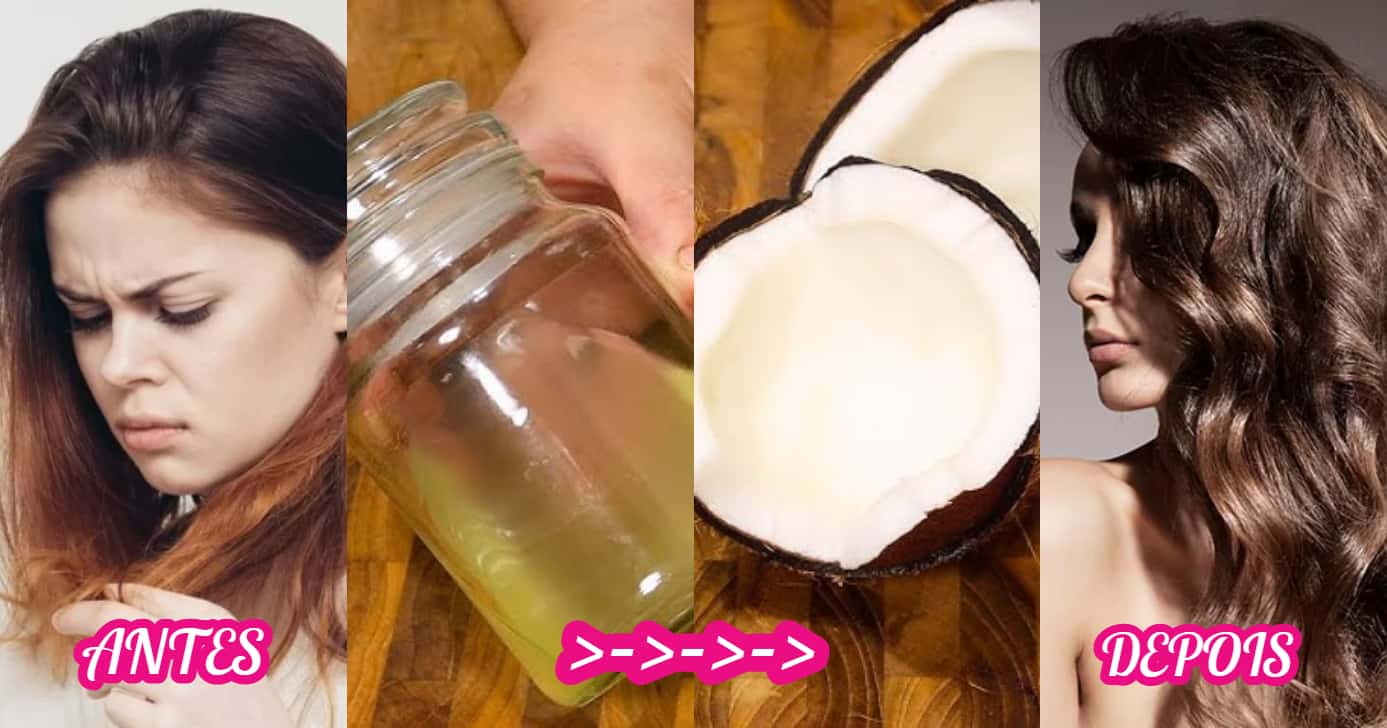 Conheça a receita caseira de óleo de coco que dá vida ao seu cabelo (Foto: Divulgação)