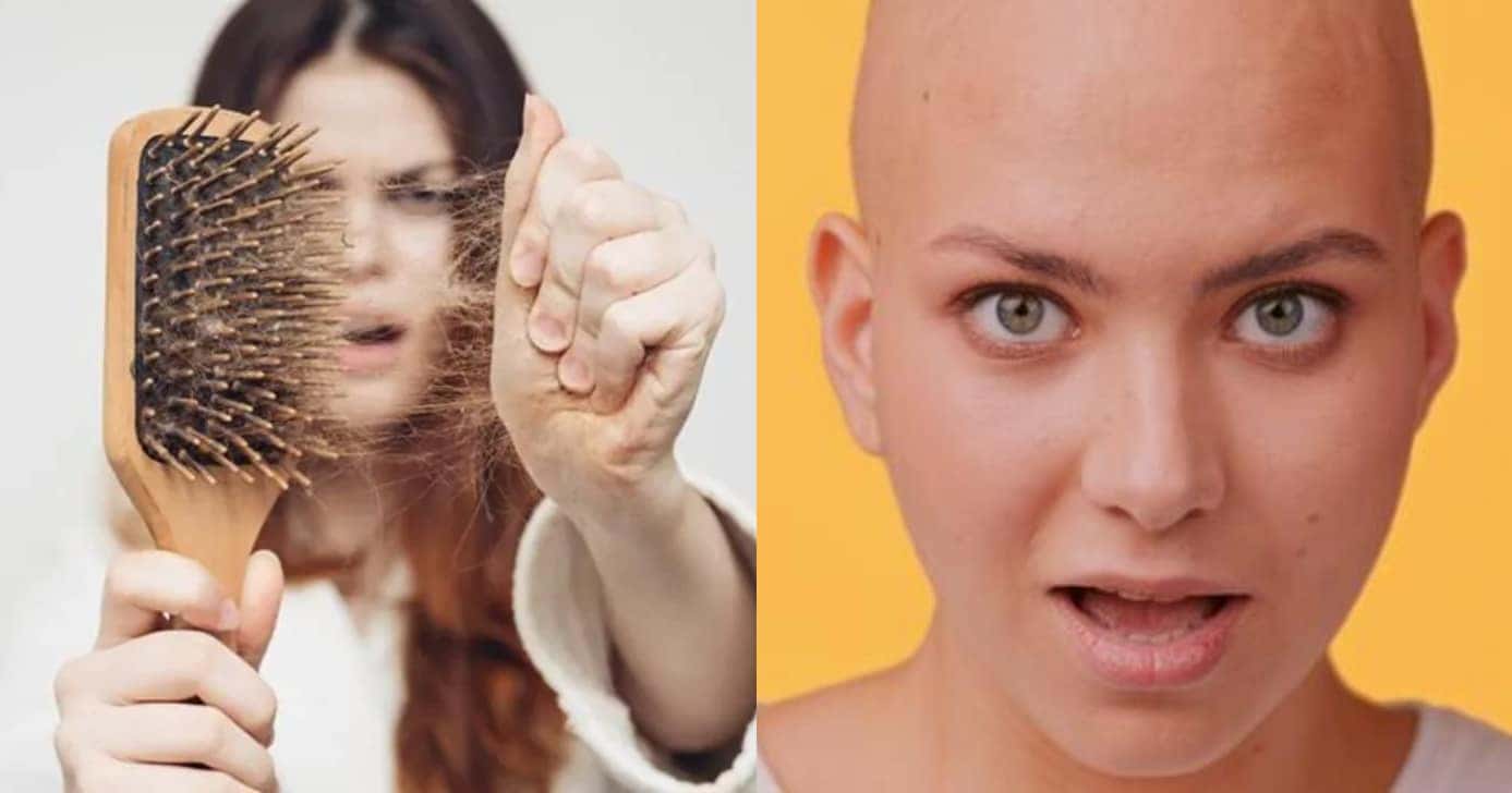 Queda de cabelo exagerada pode te deixar careca (Foto: Divulgação)