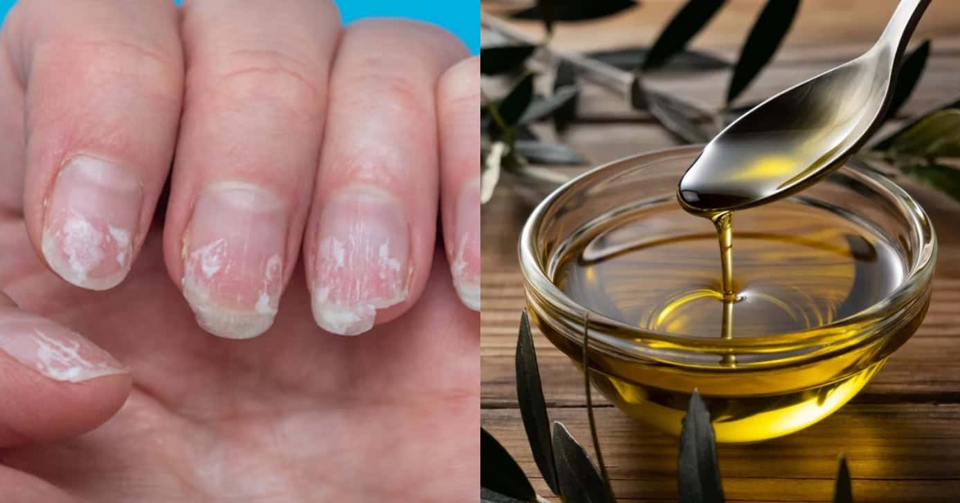 Unhas inquebráveis com azeite (Foto: Divulgação)