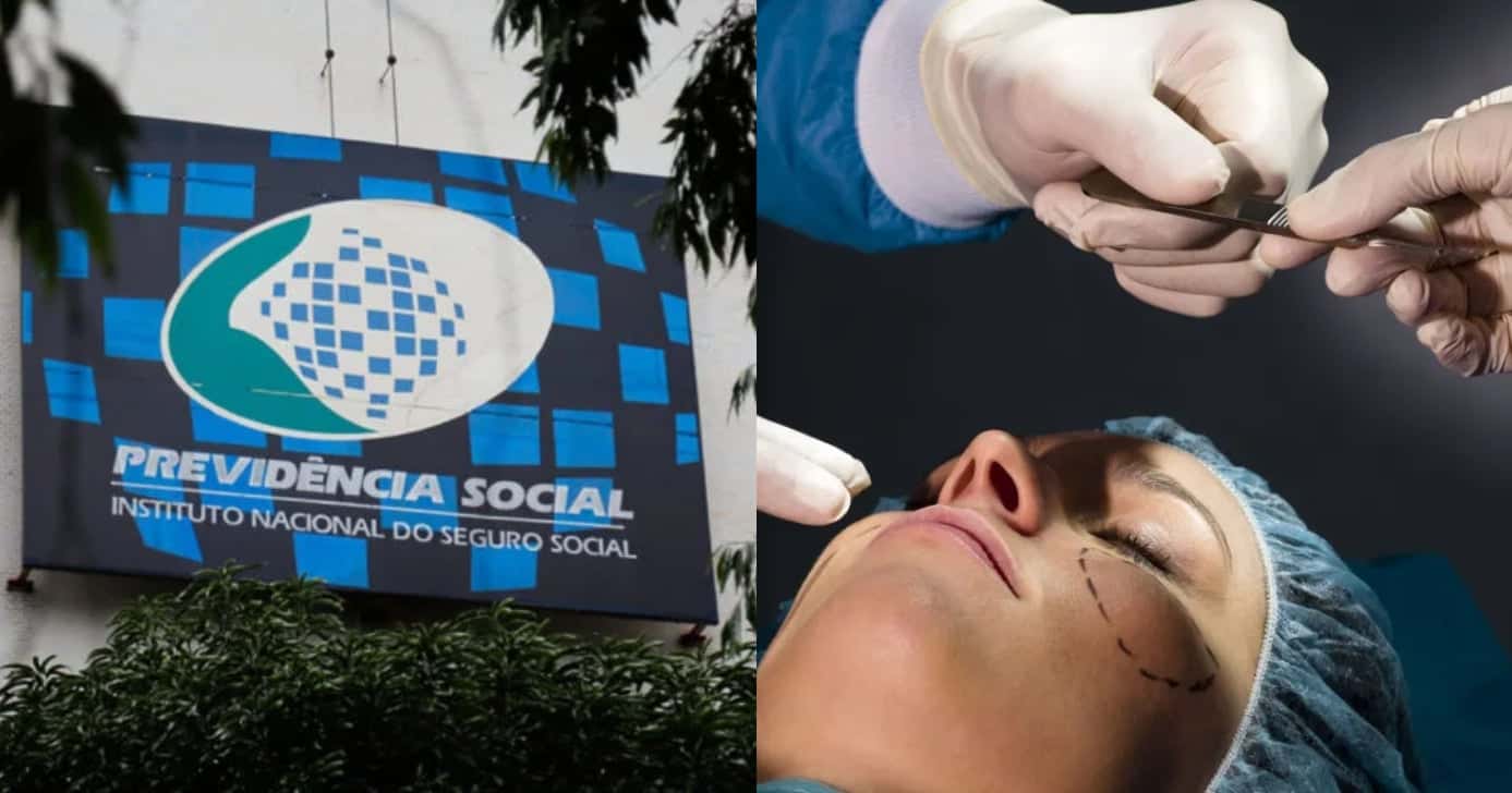 INSS pode pagar auxílio para quem faz plásticas (Foto: Divulgação)