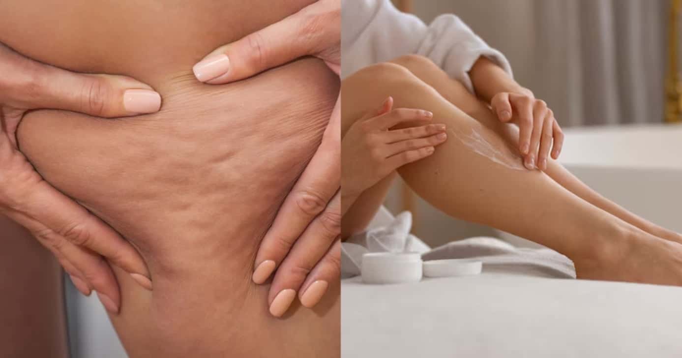 Produto Nivea para combater a celulite (Foto: Divulgação)