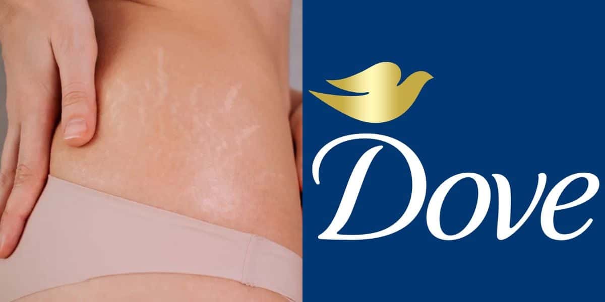 Sérum da Dove para acabar com estrias e cicatrizes da pele (Reprodução: Montagem TV Foco)