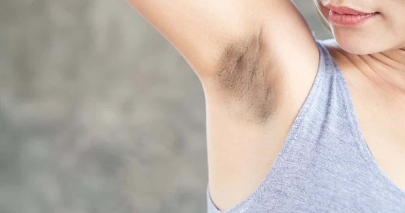 Axilas escuras? Veja como resolver (Foto: Divulgação)
