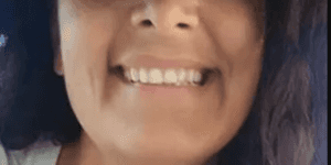 Imagem card com fundo