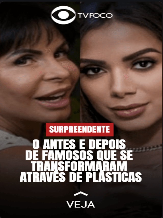 Famosos se transformam após plásticas