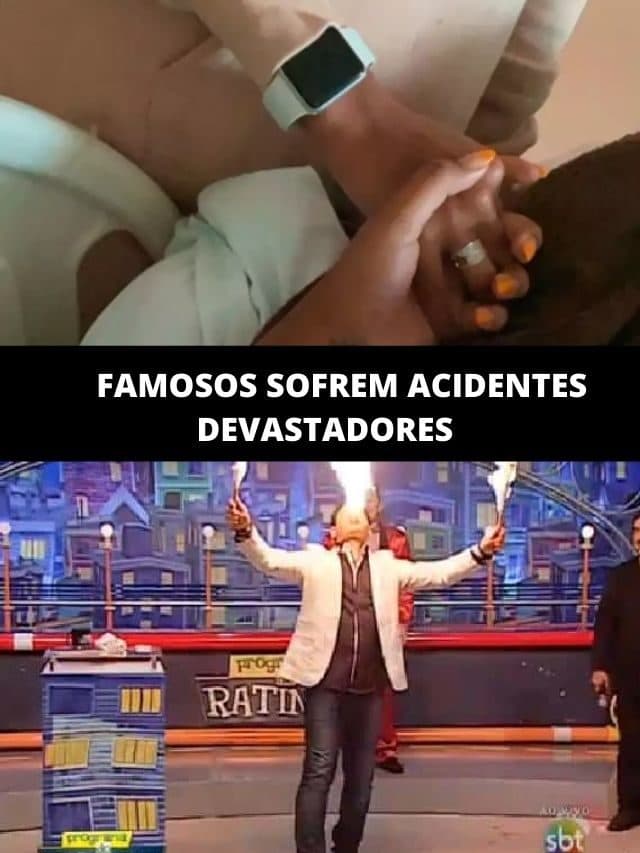 Amputação, paralisia e fogo na garganta: Famosos sofrem acidentes