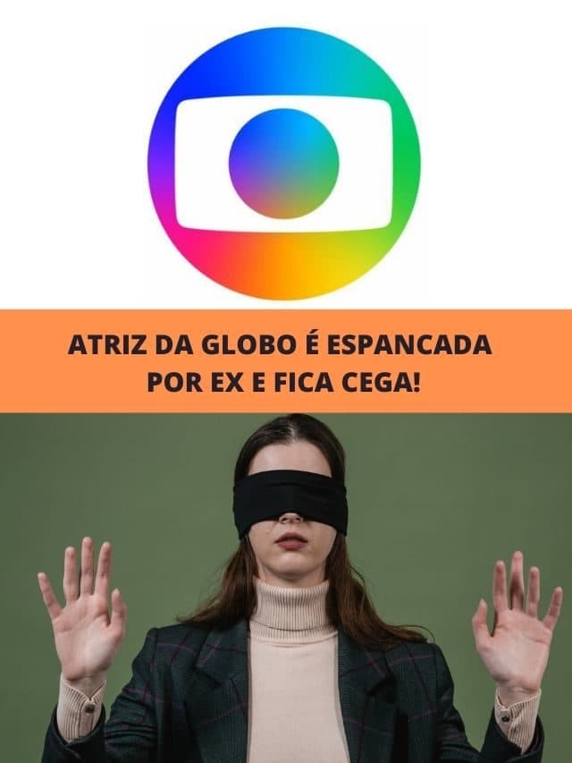 Atriz da Globo é espancada por ex e fica cega!