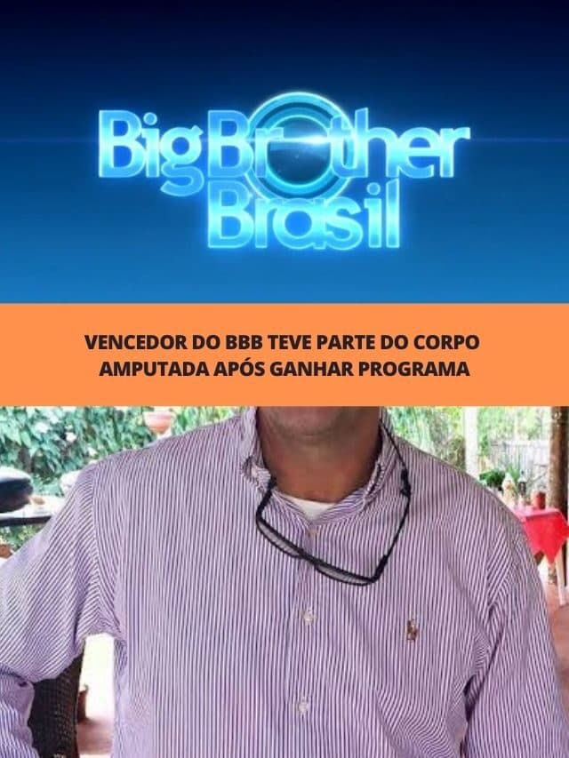 Vencedor do BBB teve parte do corpo amputada após ganhar programa