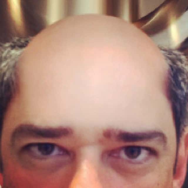 (Imagem de reprodução da internet).