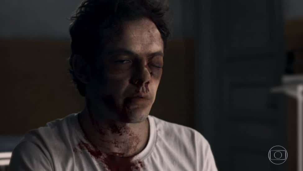 Gael surgiu completamente desfigurado na novela O Outro Lado do Paraíso. (Foto: Reprodução/Globo)