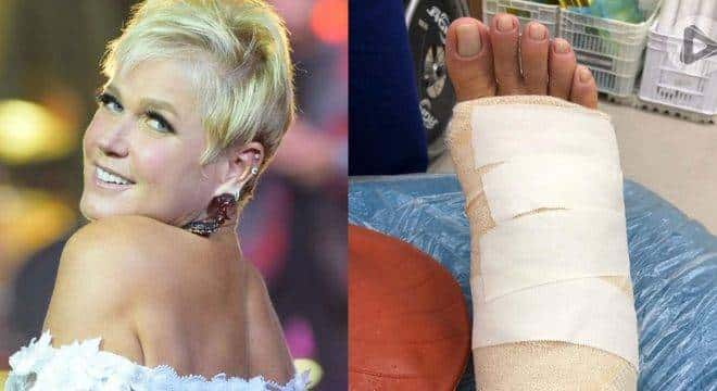 Xuxa quebra o pé (Foto: Reprodução/R7)