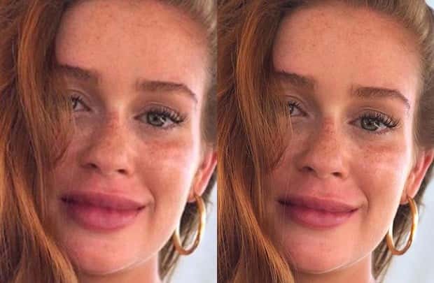 Atriz foi acusada de ter feito preenchimento labial (Foto: Reprodução)