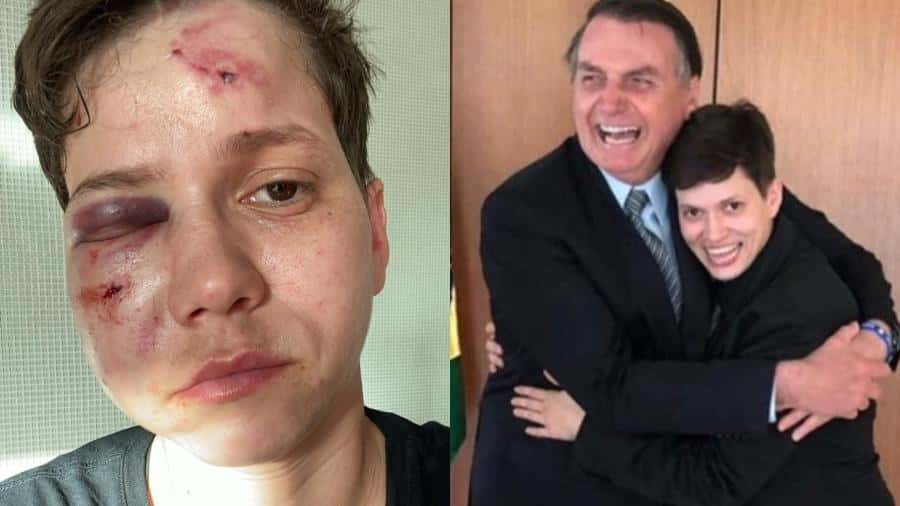 A youtuber Karol Eller, youtuber apoiadora de Bolsonaro, foi agredida (Foto: Reprodução)