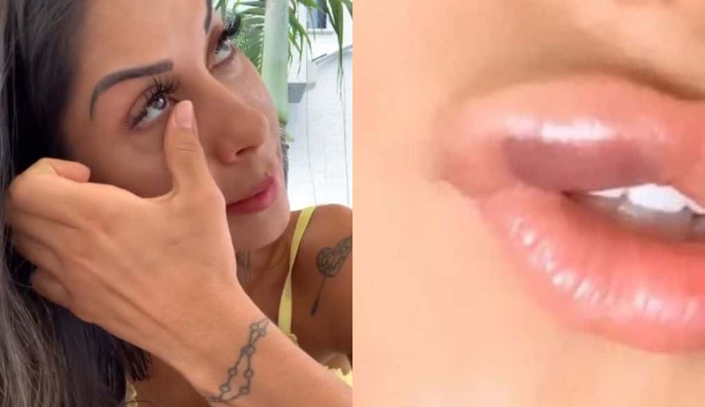 Mayra Cardi ficou com boca machucada após se envolver em acidente com a filha (Foto: Montagem/TV Foco)