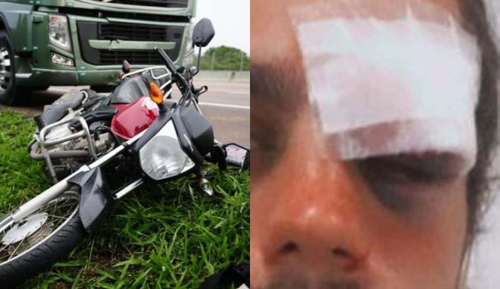 Thaigo Consani sofreu acidente de moto e acabou ficando com o rosto machucado (Foto: Montagem/TV Foco)
