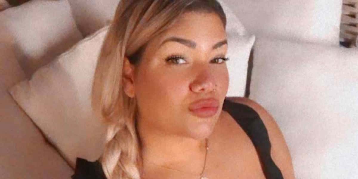 Mulher Filé corre risco de vida caso não trate líquido em seios após complicações de silicone (Foto: Reprodução)