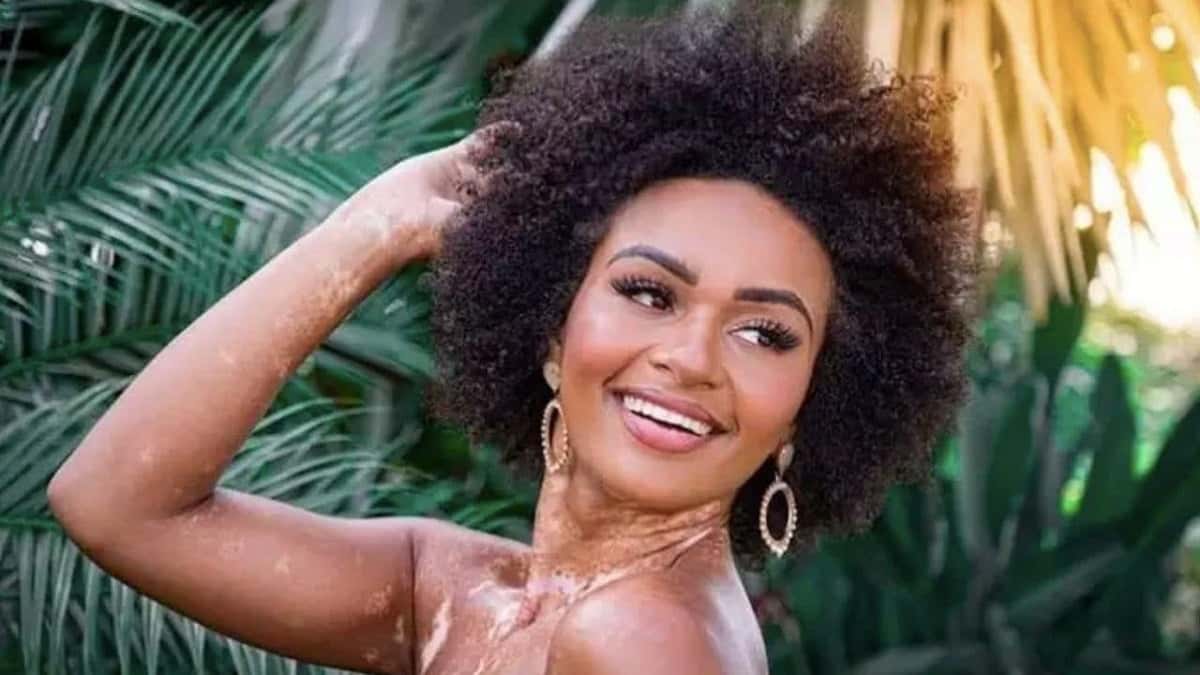 Natália Deodato revelou falta de contato - Foto: Divulgação
