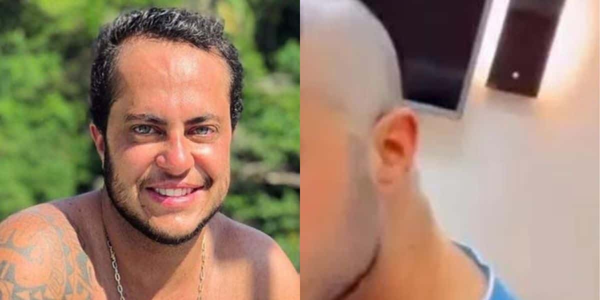 Thammy Miranda surge careca, com aparência diferente e confessa o que aconteceu ao público: "Transplante" - Reprodução