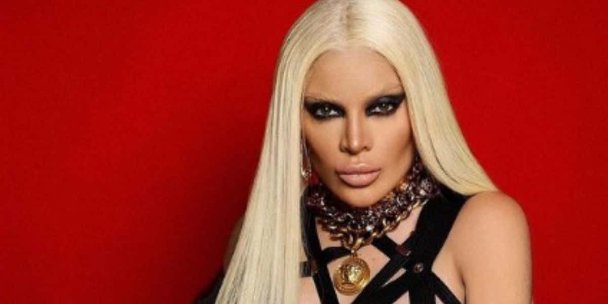 Gkay mostrou aos fãs as mudanças absurdas após retirar as harmonizações (Reprodução - Instagram)