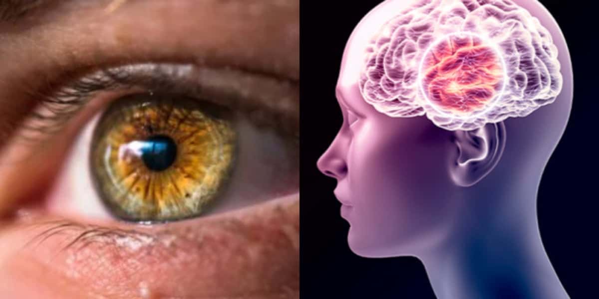 Estudos comprovam que doenças cognitivas como Alzheimer podem ser diagnosticadas preventivamente pelos olhos (Foto Reprodução/Montagem/TV Foco)