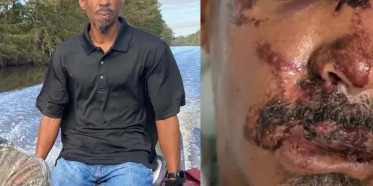O participante do reality show, Moonshiners, o americano, Craig Landry hospitalizado - Foto Reprodução Internet