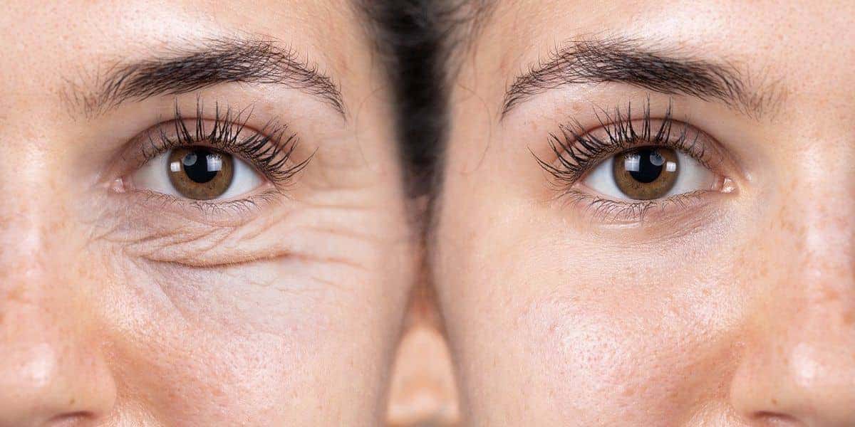 Misturinhas para ter lifiting natural (Reprodução/Internet)