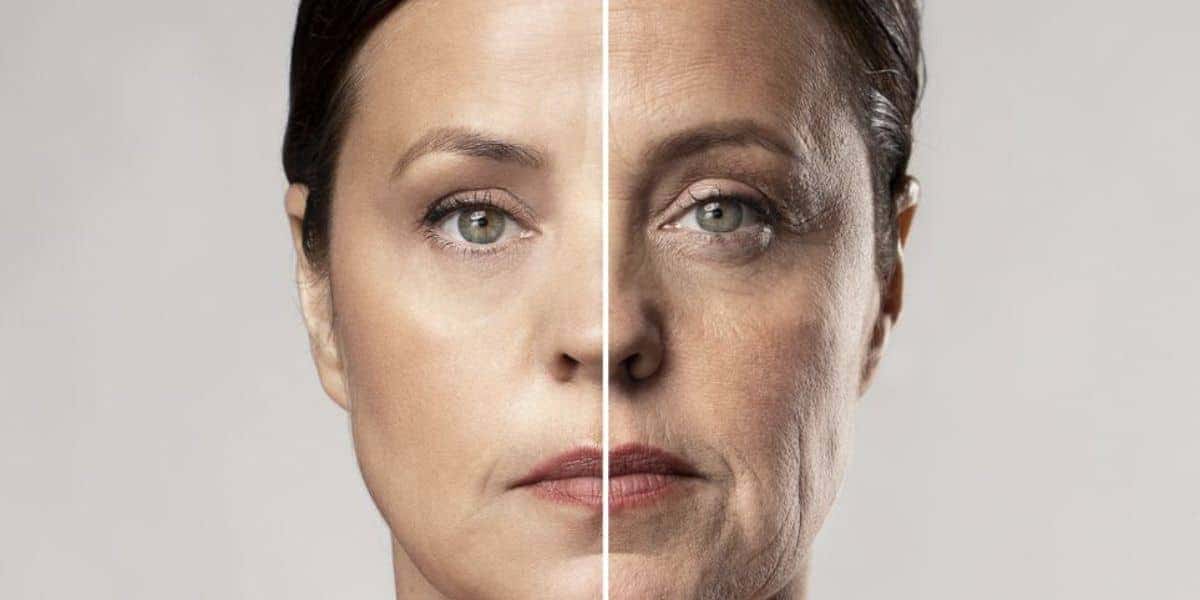 Técnica infalível faz você rejuvenescer e ter lifting natural (Reprodução/Internet)