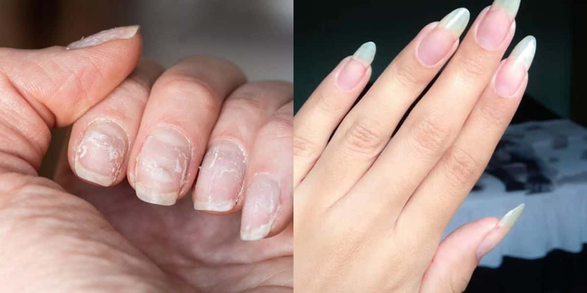 Unhas fracas / Unhas fortes - Montagem TVFOCO