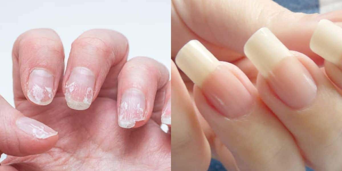 Unhas fracas / Unhas fortes - Montagem TVFOCO