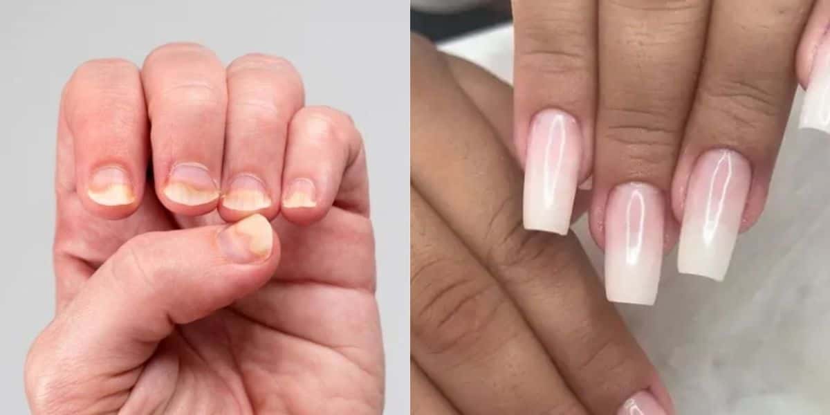 Unhas fracas / Unhas fortes - Montagem TVFOCO