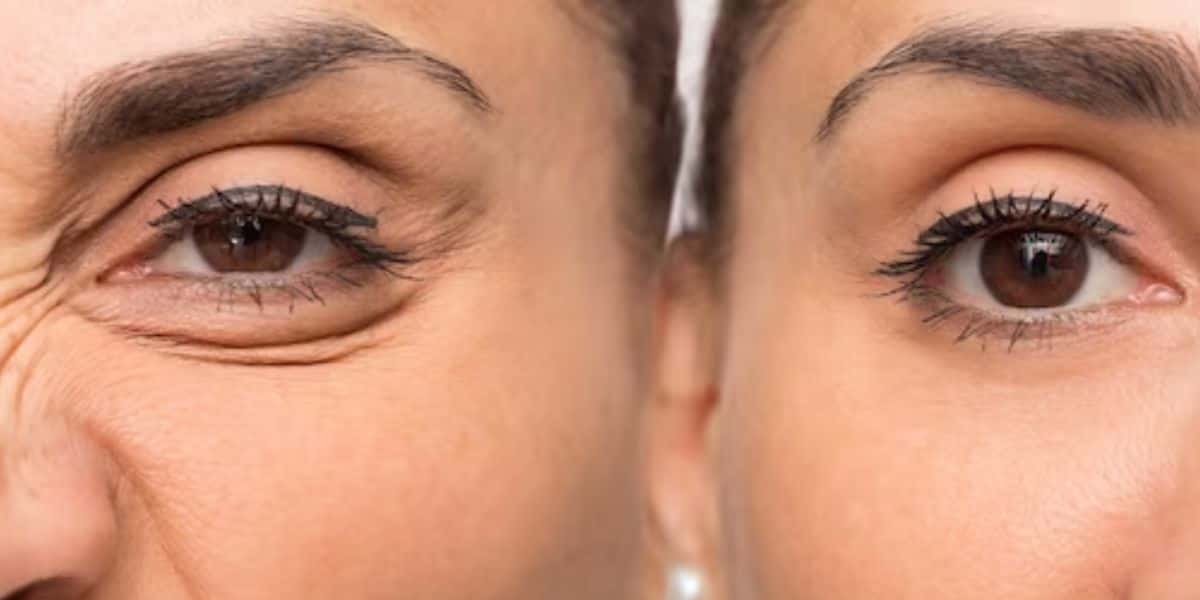 A harmonização facial caseira te rejuvenesce em até 30 anos (Reprodução: Montagem TV Foco)