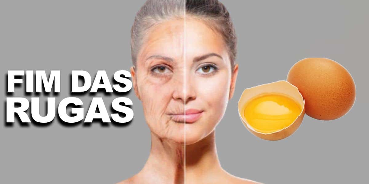 Fim das rugas - Clara de Ovo (Foto: Reprodução, Montagem - TV Foco)