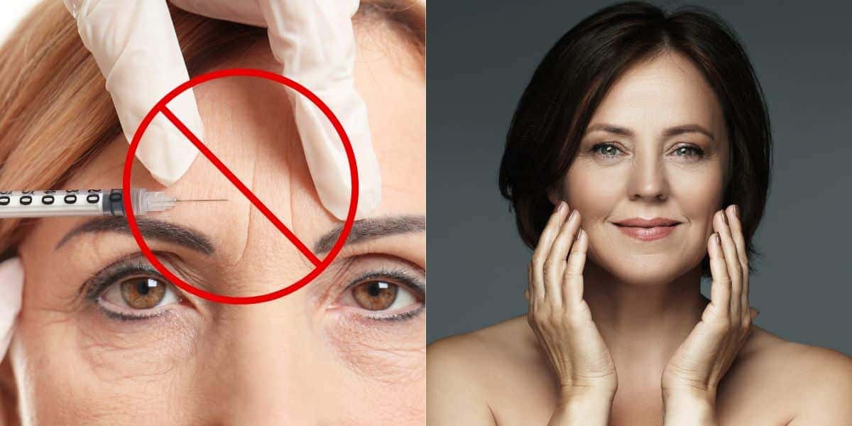Pele esticada e Botox natural - Foto Reprodução Internet