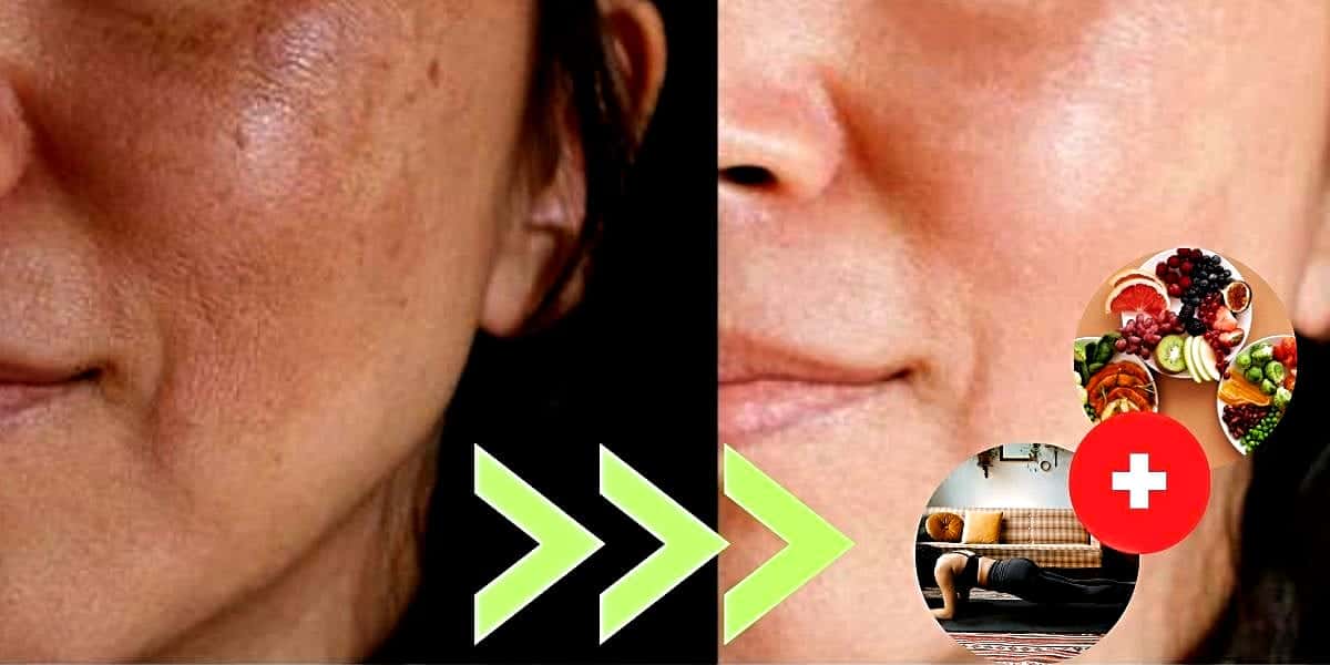 Saiba como eliminar os poros dilatados em 6 passos (Foto Reprodução/Montagem/Lennita/Tv Foco/Canva/)