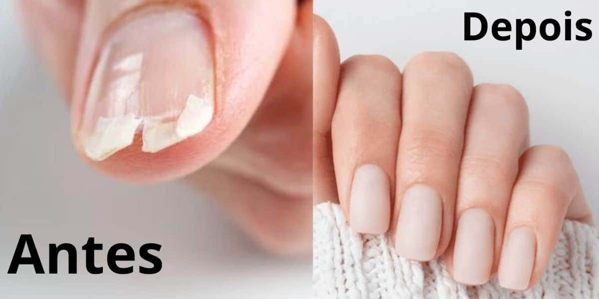 Dê adeus as unhas quebradiças com esses 10 alimentos (Reprodução: Montagem TV Foco)