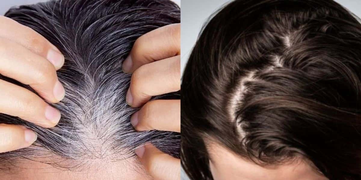 Receitinha caseira só com 4 ingredientes pra acabar com o cabelo branco - Foto: Internet