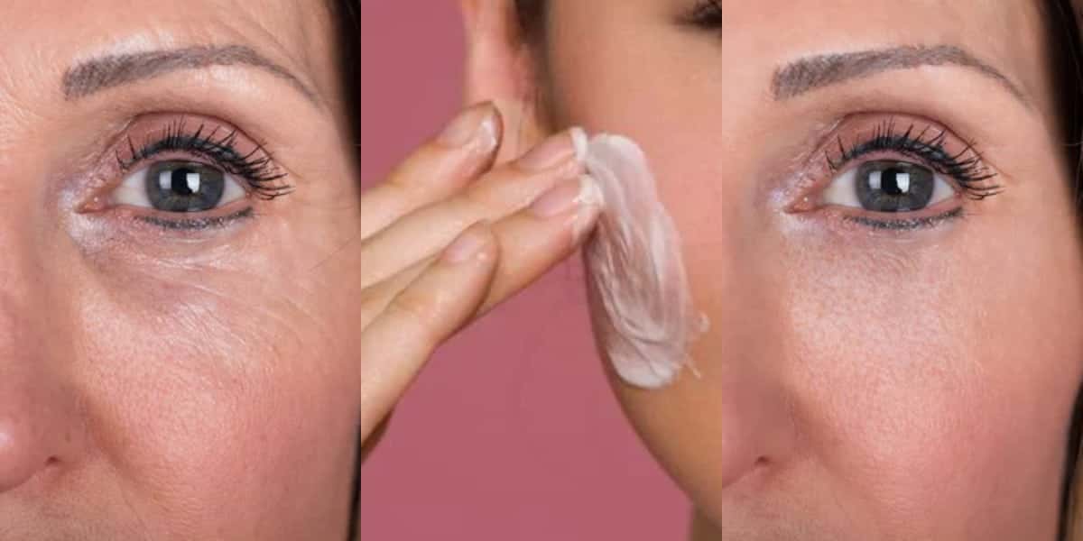 O adeus as rugas usando esse único ingrediente (Foto: Divulgação)